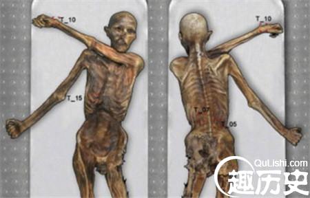 5300年前就有纹身-最古老纹身在冰人奥茨身上