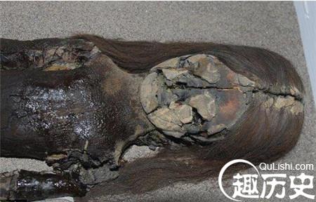 揭秘世界上最古老的木乃伊竟然死于中毒!